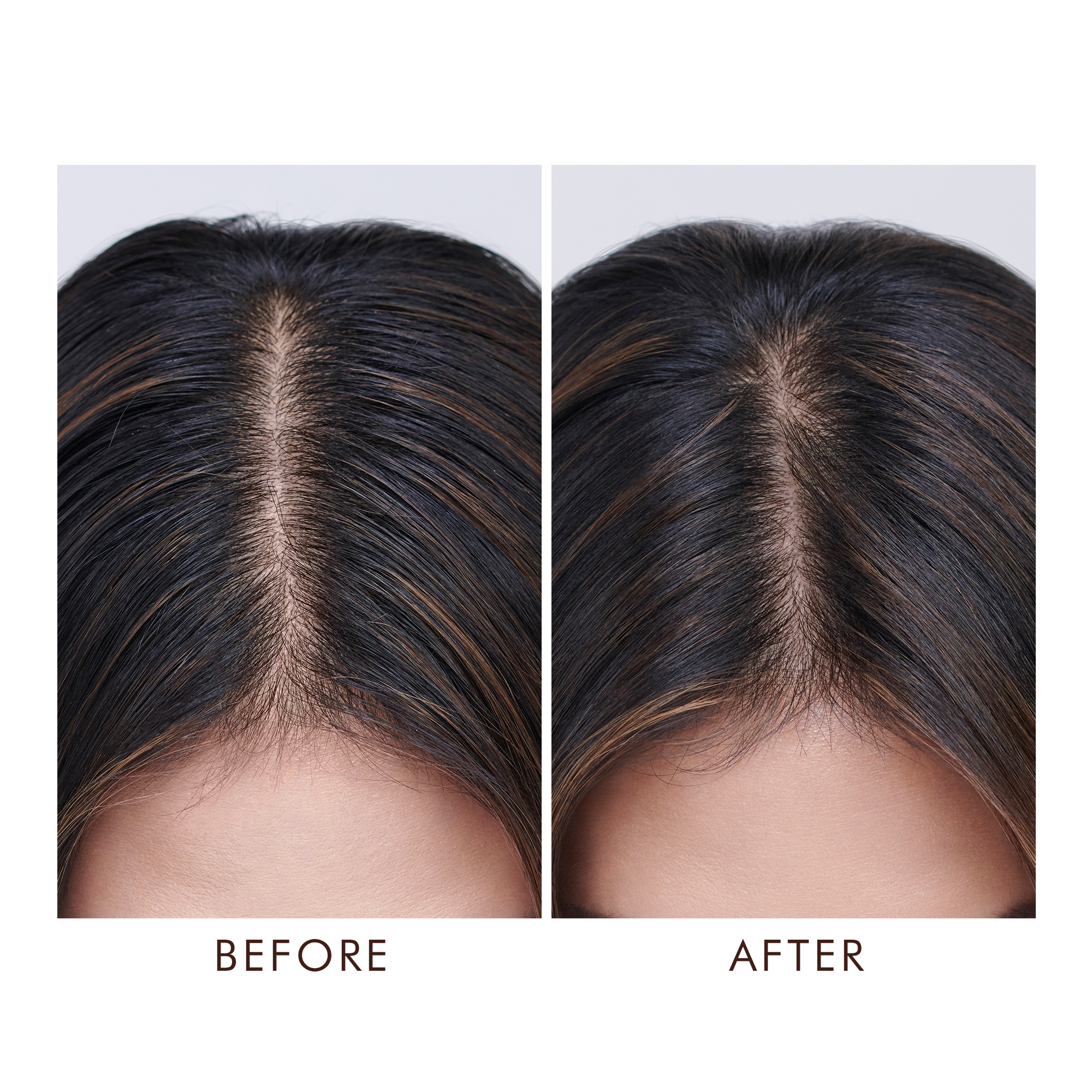OILY SCALP TREATMENT (SUERO PARA CABELLO)